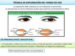 TÉCNICA DE EXPLORACIÓN DEL FONDO DE OJO 
La exploración debe realizarse en una habitación en penumbra. 
Es conveniente una buena dilatación pupilar para examinar correctamente la retina. 
LOS PRINCIPALES PASOS A REALIZAR SON: 
1. El explorador se debe situar enfrente y hacia un lado del paciente, colocando el dedo índice 
sobre el disco Recoss (inicialmente a 0) para ir enfocando a lo largo de la exploración. 
Pedir al paciente que mire a un punto lejano. 
 