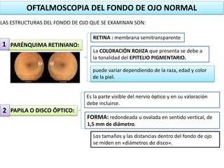 OFTALMOSCOPIA DEL FONDO DE OJO NORMAL 
LAS ESTRUCTURAS DEL FONDO DE OJO QUE SE EXAMINAN SON: 
PARÉNQUIMA RETINIANO: 
PAPILA O DISCO ÓPTICO: 
RETINA : membrana semitransparente 
La COLORACIÓN ROJIZA que presenta se debe a 
la tonalidad del EPITELIO PIGMENTARIO. 
puede variar dependiendo de la raza, edad y color 
de la piel. 
Es la parte visible del nervio óptico y en su valoración 
debe incluirse. 
FORMA: redondeada u ovalada en sentido vertical, de 
1,5 mm de diámetro. 
Los tamaños y las distancias dentro del fondo de ojo 
se miden en «diámetros de disco». 
1 
2 
 