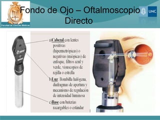 Fondo de Ojo – Oftalmoscopio
          Directo
 