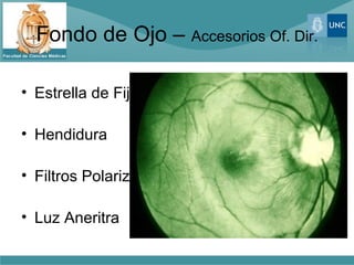 Fondo de Ojo – Accesorios Of. Dir.

• Estrella de Fijacion

• Hendidura

• Filtros Polarizados

• Luz Aneritra
 