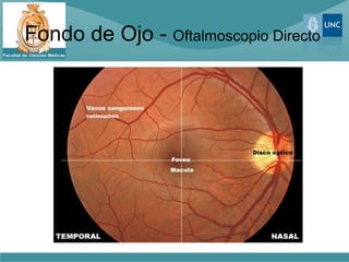 Fondo de Ojo - Oftalmoscopio Directo
 