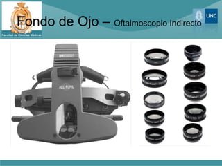 Fondo de Ojo – Oftalmoscopio Indirecto
 