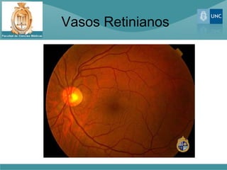 Vasos Retinianos
 