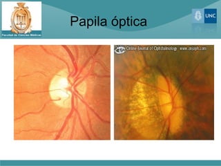 Papila óptica
 