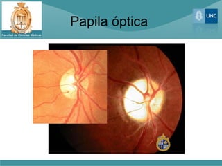 Papila óptica
 