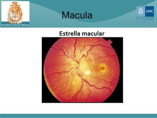 Macula
Estrella macular
 