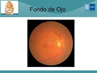 Fondo de Ojo
 