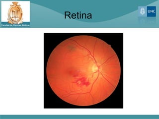 Retina
 