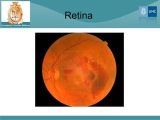 Retina
 
