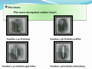 Pita Suara
Pita suara merupakan sumber bunyi.
Gambar 2.3a Tertutup Gambar 2.3b Terbuka sedikit
Gambar 2.3c terbuka agak lebar Gambar 2.3d terbuka seluruhnya
 