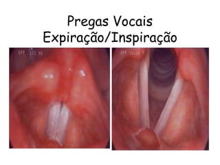 Pregas Vocais
Expiração/Inspiração
 