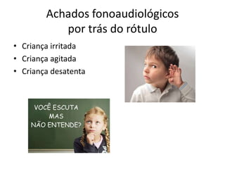 Achados fonoaudiológicos
por trás do rótulo
• Criança irritada
• Criança agitada
• Criança desatenta

 
