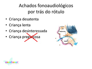 Achados fonoaudiológicos
por trás do rótulo
•
•
•
•

Criança desatenta
Criança lenta
Criança desinteressada
Criança preguiçosa

 