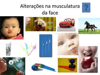 Alterações na musculatura
da face

 