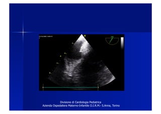 Divisione di Cardiologia Pediatrica
Azienda Ospedaliera Materno-Infantile O.I.R.M.- S.Anna, Torino
 