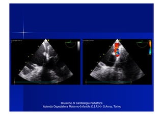 Divisione di Cardiologia Pediatrica
Azienda Ospedaliera Materno-Infantile O.I.R.M.- S.Anna, Torino
 
