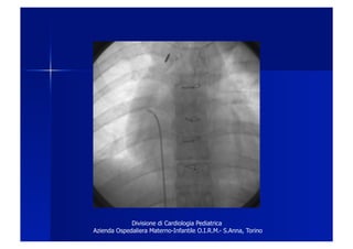 Divisione di Cardiologia Pediatrica
Azienda Ospedaliera Materno-Infantile O.I.R.M.- S.Anna, Torino
 