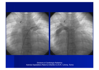 Divisione di Cardiologia Pediatrica
Azienda Ospedaliera Materno-Infantile O.I.R.M.- S.Anna, Torino
 