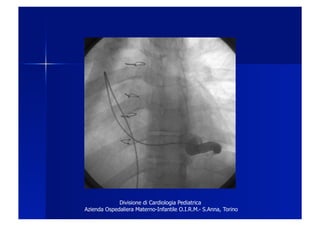 Divisione di Cardiologia Pediatrica
Azienda Ospedaliera Materno-Infantile O.I.R.M.- S.Anna, Torino
 