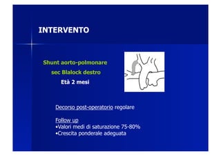 INTERVENTO



Shunt aorto-polmonare
  sec Blalock destro
      Età 2 mesi



    Decorso post-operatorio regolare

    Follow up
    • Valori medi di saturazione 75-80%
    • Crescita ponderale adeguata
 