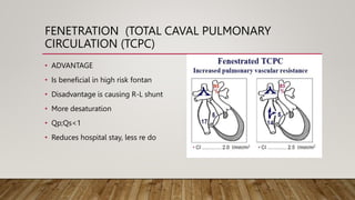 FENETRATION (TOTAL CAVAL PULMONARY
CIRCULATION (TCPC)
• ADVANTAGE
• Is beneficial in high risk fontan
• Disadvantage is causing R-L shunt
• More desaturation
• Qp;Qs<1
• Reduces hospital stay, less re do
 