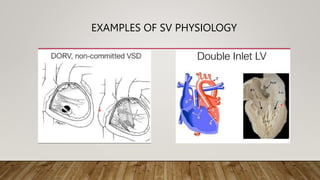 EXAMPLES OF SV PHYSIOLOGY
 