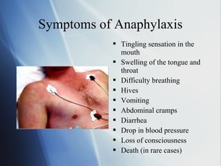 Symptoms of Anaphylaxis
 Tingling sensation in the
mouth
 Swelling of the tongue and
throat
 Difficulty breathing
 Hives
 Vomiting
 Abdominal cramps
 Diarrhea
 Drop in blood pressure
 Loss of consciousness
 Death (in rare cases)
 