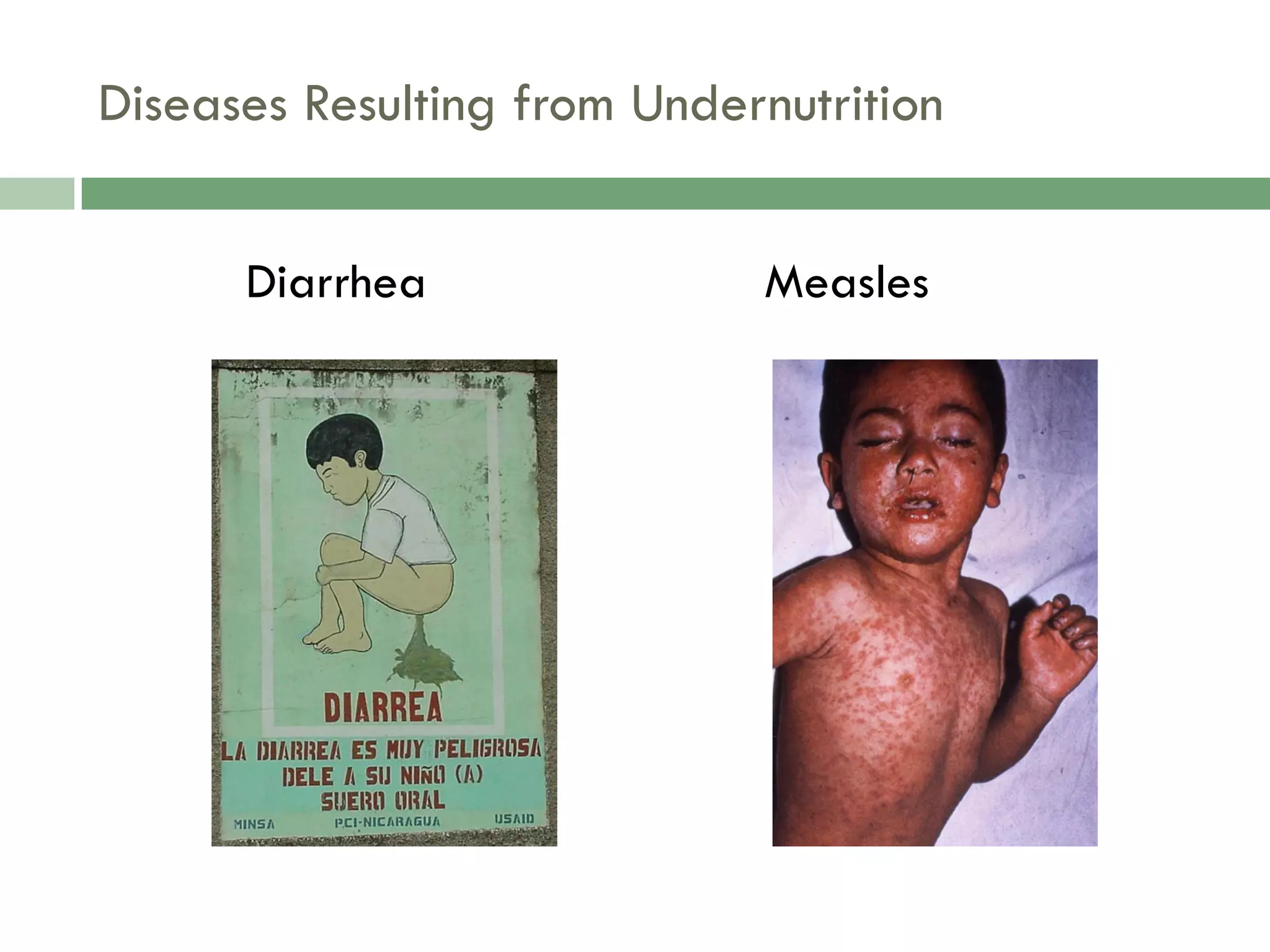 Food Resources Part I - Agriculture