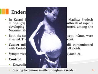 Endemic ascitis
• In Kusmi Block of Sarguja district in Madhya Pradesh
during 1973 and again during 1976, an outbreak of rapidly
developing ascites and jaundice was reported among the
Nagesia tribals.
• Both the sexes and all the age groups, except infants, were
affected. The overall mortality was 40 per cent.
• Cause: millet Panicum miliare (gondhli) contaminated
with Crotalaria (jhunjhunia); hepatotoxic alkaloids.
• Symptoms: rapidly developing ascitis with jaundice.
• Control:
• Deweeding jhunjhunia.
• Sieving to remove smaller jhunjhunia seeds. 94
 