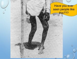 Have you ever
seen people like
this???
 