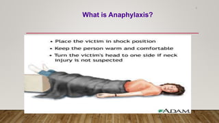 8
What is Anaphylaxis?
 