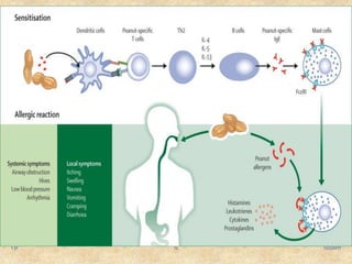 Food allergies and food intolerances ppt | PPTX
