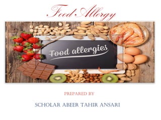 PrePared by
Scholar abeer Tahir anSari
Food Allergy
 