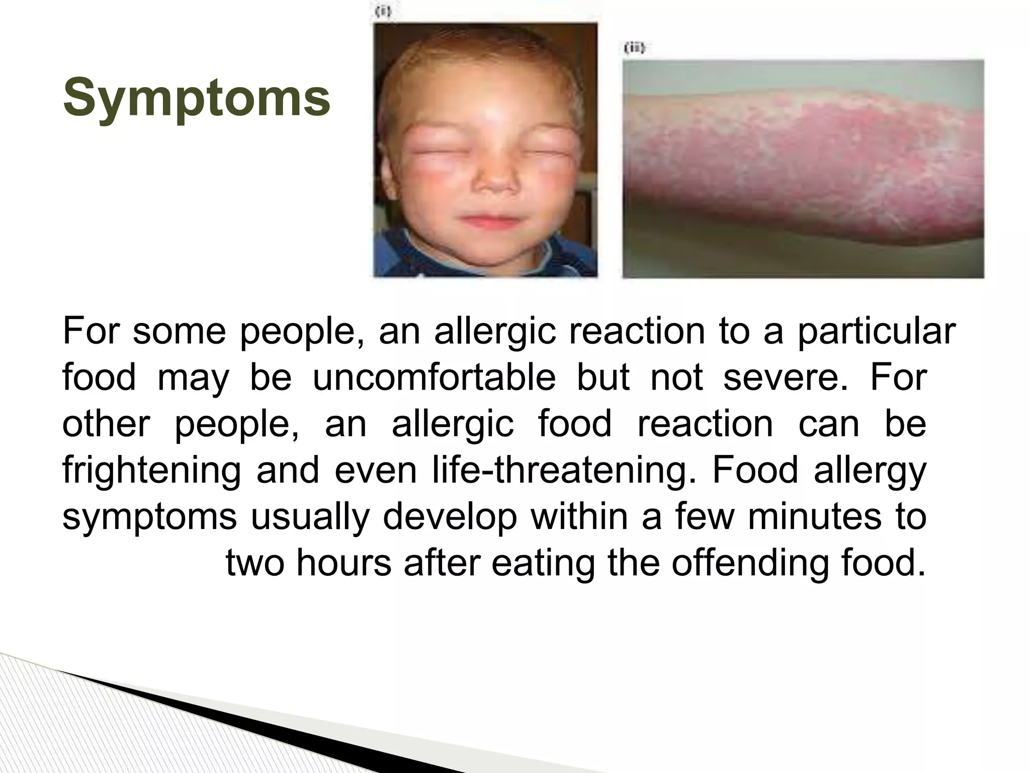 Photo inspiration: Visual Reference: Food Allergy Pptx