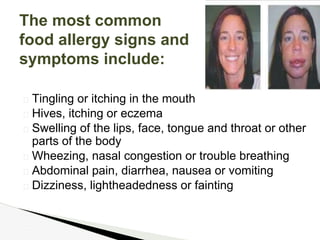 � Tingling or itching in the mouth
� Hives, itching or eczema
� Swelling of the lips, face, tongue and throat or other
par...