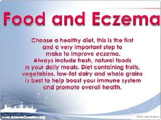 FOOD AND ECZEMA

 