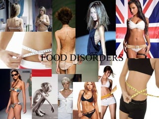FOOD DISORDERS 