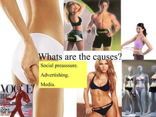 Social preasssure. Advertishing. Media. Whats are the causes? 
