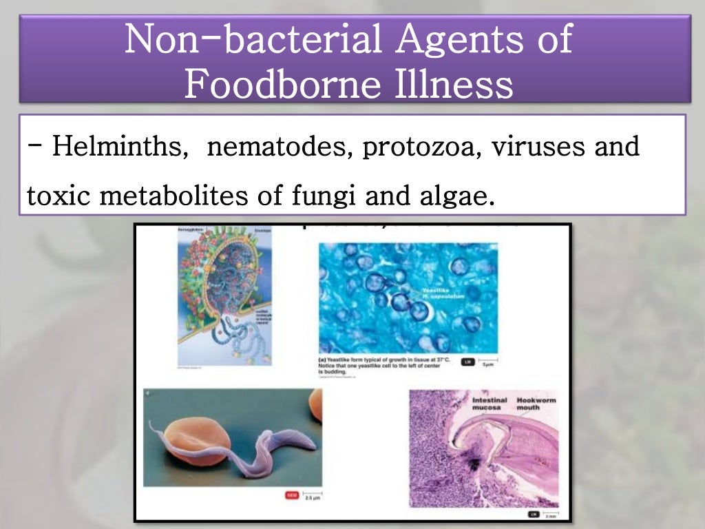 Food hazard & non bacterial agents of foodborne illness