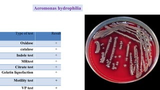 Aeromonas hydrophilia
 