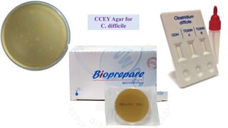 CCEY Agar for
C. difficile
 