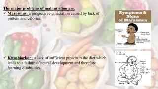 The major problems of malnutrition are:
 Marasmus: a progressive emaciation caused by lack of
protein and calories.
 Kwashiorkor : a lack of sufficient protein in the diet which
leads to a failure of neural development and therefore
learning disabilities.
 