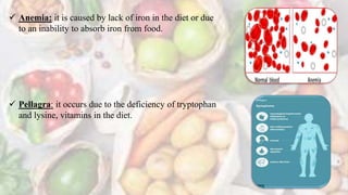  Anemia: it is caused by lack of iron in the diet or due
to an inability to absorb iron from food.
 Pellagra: it occurs due to the deficiency of tryptophan
and lysine, vitamins in the diet.
 