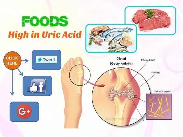 do you know 5 foods high in uric acid to avoid gout attacks
