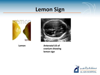 Food signs in radiology pp ta | PPTX