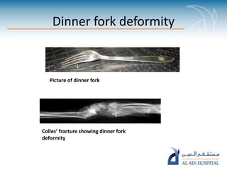 Distorted Fork Food signs in radiology pp ta | PPTX