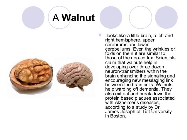 Foods Associated With Alzheimer S Foods Associated With Alzheimer S