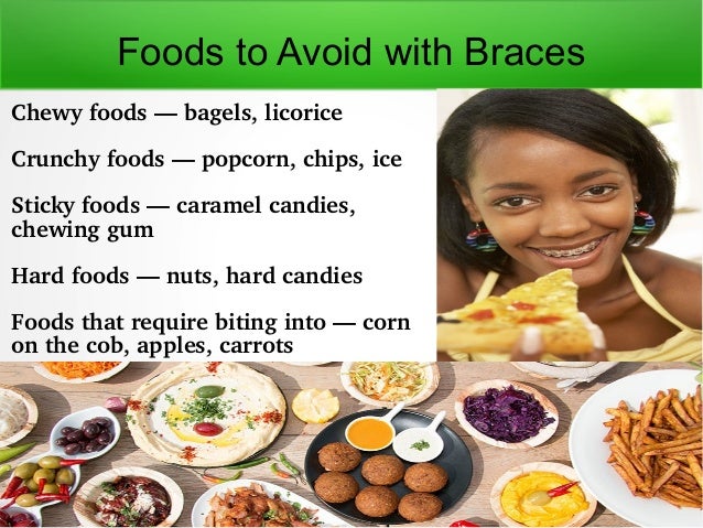 Foods To Avoid With Braces 