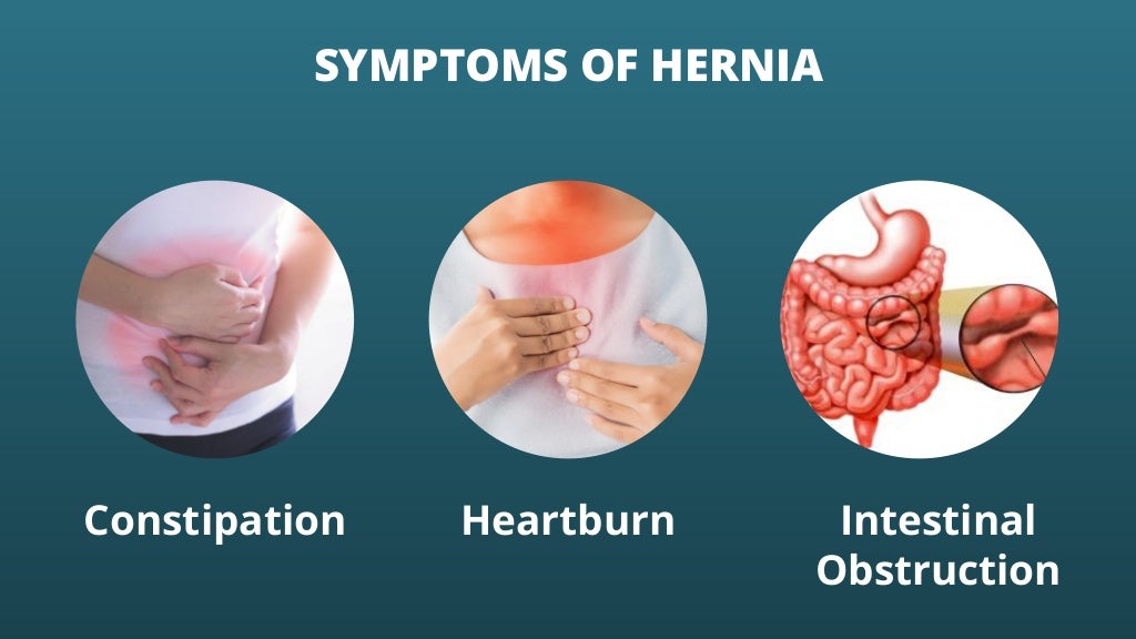 Foods To Eat And Avoid While Having Hernia
