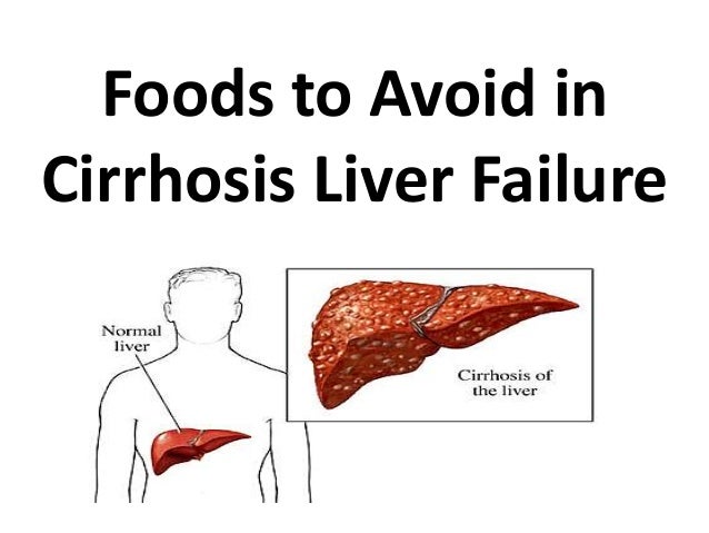 Diets For End Stage Liver Failure